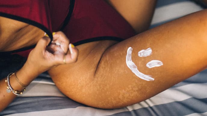 Sonnencreme Flecken Sonnencreme Flecken